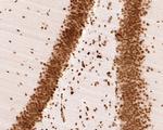 H3K18ac Antibody in Immunohistochemistry (Paraffin) (IHC (P))