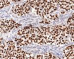 SALL4 Antibody in Immunohistochemistry (Paraffin) (IHC (P))