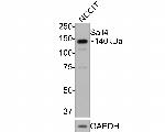 SALL4 Antibody in Western Blot (WB)