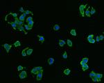 CX3CR1 Antibody in Immunocytochemistry (ICC/IF)