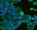 TROP2 Antibody in Immunocytochemistry (ICC/IF)