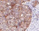 TROP2 Antibody in Immunohistochemistry (Paraffin) (IHC (P))