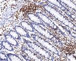 RUNX3 Antibody in Immunohistochemistry (Paraffin) (IHC (P))