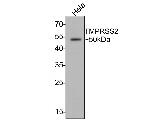 TMPRSS2 Antibody in Western Blot (WB)