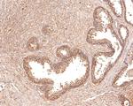 IL11RA Antibody in Immunohistochemistry (Paraffin) (IHC (P))