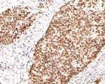 NCoR1 Antibody in Immunohistochemistry (Paraffin) (IHC (P))