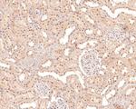 NCoR1 Antibody in Immunohistochemistry (Paraffin) (IHC (P))