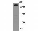 NCoR1 Antibody in Western Blot (WB)