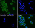 TSC1 Antibody in Immunocytochemistry (ICC/IF)