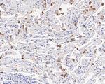 Cathepsin D Antibody in Immunocytochemistry (ICC/IF)