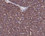 Cathepsin D Antibody in Immunohistochemistry (Paraffin) (IHC (P))