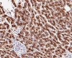 Cathepsin D Antibody in Immunohistochemistry (Paraffin) (IHC (P))