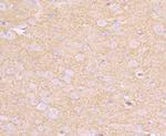 CD146 Antibody in Immunohistochemistry (Paraffin) (IHC (P))