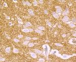 CD146 Antibody in Immunohistochemistry (Paraffin) (IHC (P))