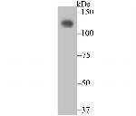 CD146 Antibody in Western Blot (WB)