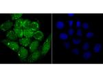 alpha Synuclein Antibody in Immunocytochemistry (ICC/IF)