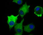 Vinculin Antibody in Immunocytochemistry (ICC/IF)