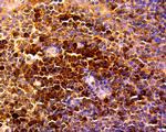 CCL5 (RANTES) Antibody in Immunohistochemistry (Paraffin) (IHC (P))