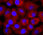 CD56 (NCAM) Antibody in Immunocytochemistry (ICC/IF)