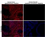 CD56 (NCAM) Antibody in Immunohistochemistry (Paraffin) (IHC (P))