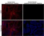 CD56 (NCAM) Antibody in Immunohistochemistry (Paraffin) (IHC (P))