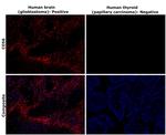 CD56 (NCAM) Antibody in Immunohistochemistry (Paraffin) (IHC (P))