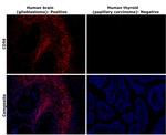 CD56 (NCAM) Antibody