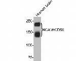 CD56 (NCAM) Antibody in Western Blot (WB)