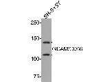 CD56 (NCAM) Antibody in Western Blot (WB)