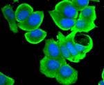 STAT4 Antibody in Immunocytochemistry (ICC/IF)