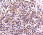 STAT4 Antibody in Immunohistochemistry (Paraffin) (IHC (P))