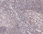 STAT4 Antibody in Immunohistochemistry (Paraffin) (IHC (P))