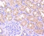 IL-1 beta Antibody in Immunohistochemistry (Paraffin) (IHC (P))