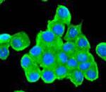 Tyrosine Hydroxylase Antibody in Immunocytochemistry (ICC/IF)