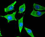 Tyrosine Hydroxylase Antibody in Immunocytochemistry (ICC/IF)