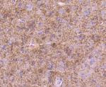 Tyrosine Hydroxylase Antibody in Immunohistochemistry (Paraffin) (IHC (P))