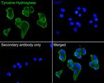 Tyrosine Hydroxylase Antibody in Immunocytochemistry (ICC/IF)