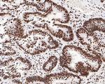 Histone H3.3 Antibody in Immunohistochemistry (Paraffin) (IHC (P))