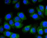 STAT6 Antibody in Immunocytochemistry (ICC/IF)