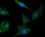 STAT6 Antibody in Immunocytochemistry (ICC/IF)