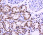 STAT6 Antibody in Immunohistochemistry (Paraffin) (IHC (P))