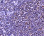 STAT6 Antibody in Immunohistochemistry (Paraffin) (IHC (P))