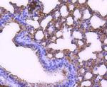 STAT6 Antibody in Immunohistochemistry (Paraffin) (IHC (P))