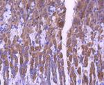 STAT6 Antibody in Immunohistochemistry (Paraffin) (IHC (P))