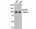 STAT6 Antibody in Western Blot (WB)