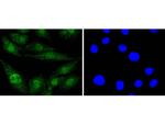 EGFR Antibody in Immunocytochemistry (ICC/IF)