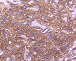 EGFR Antibody in Immunohistochemistry (Paraffin) (IHC (P))