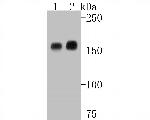 EGFR Antibody in Western Blot (WB)