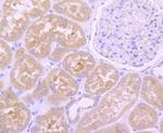 EGFR Antibody in Immunohistochemistry (Paraffin) (IHC (P))