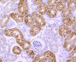 EGFR Antibody in Immunohistochemistry (Paraffin) (IHC (P))